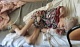 "Она кричала от боли": в сети появились фото "последствий лечения" 93-летнего Ветерана Великой Отечественной Войны